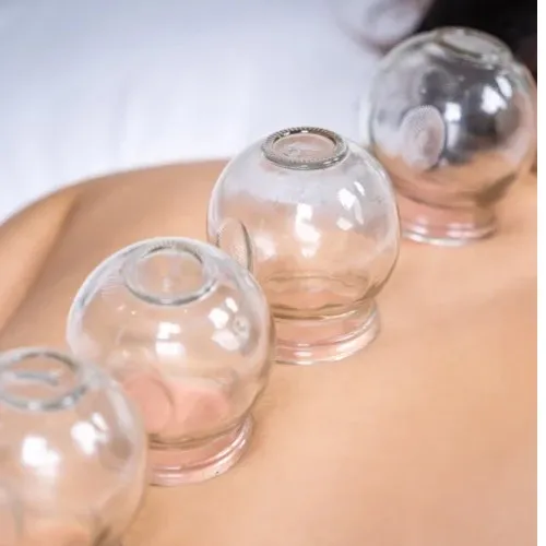Cupping Therapie bij De Prestige